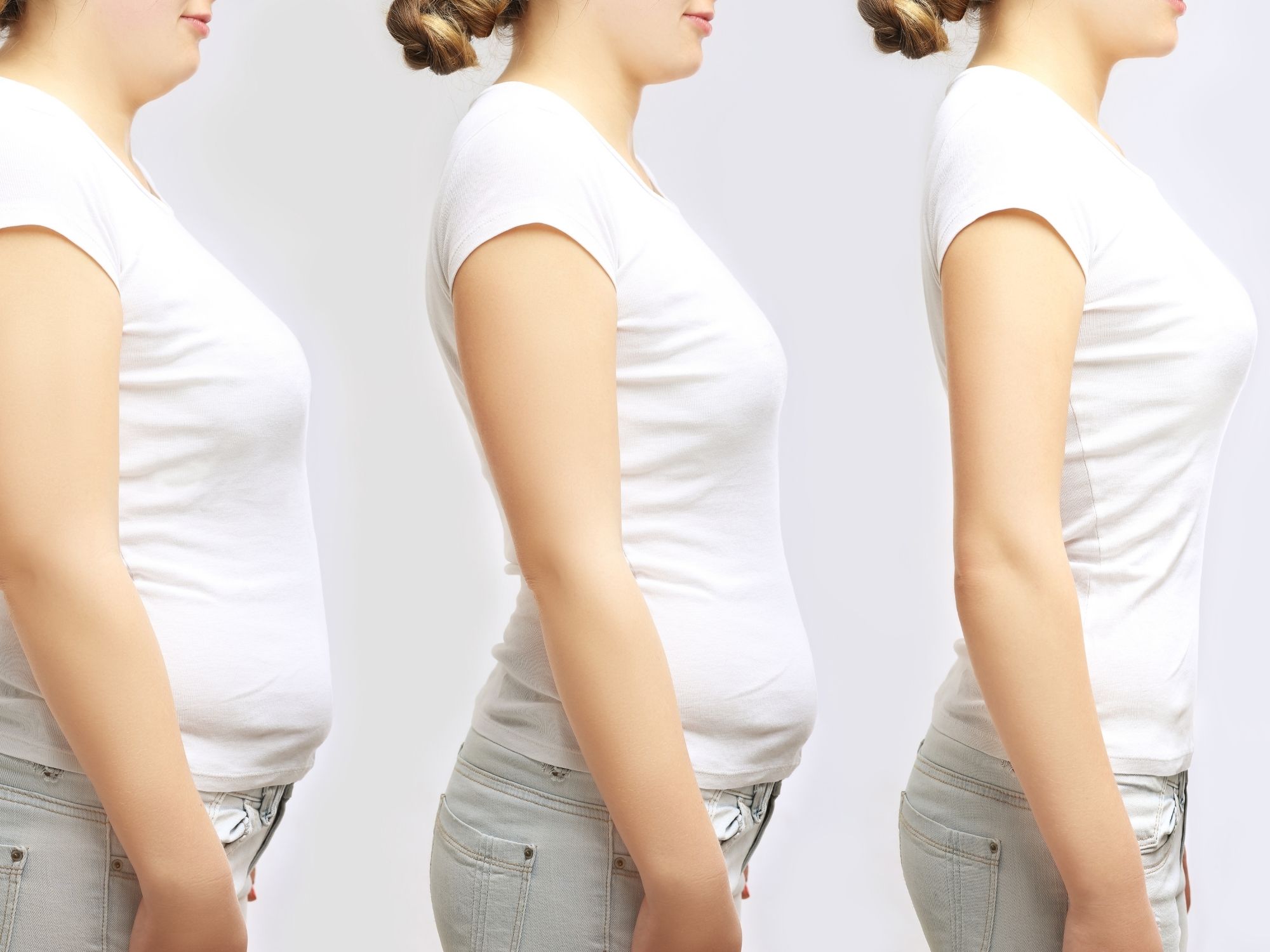 Liposculpting process